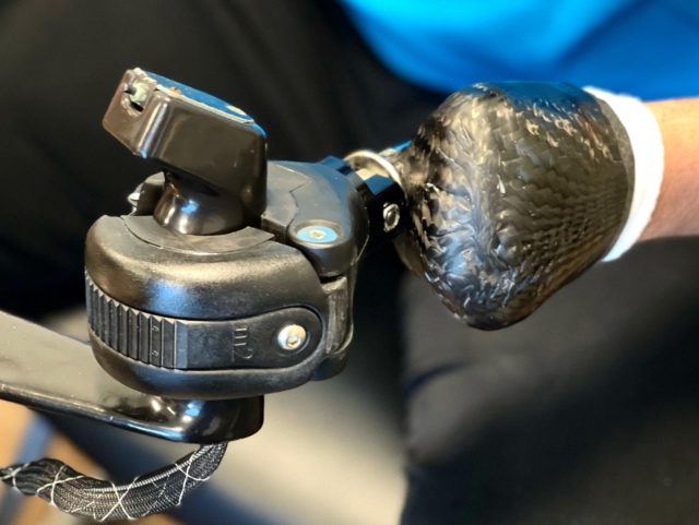 » Partial Hand Prosthesis Innovative Prosthetic Solutions, Inc.